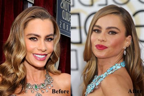 Did Sofia Vergara Have Plastic Surgery? Exploring the Rumors and Realities