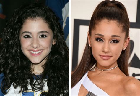 Has Ariana Grande Had Plastic Surgery? Exploring the Rumors and Realities