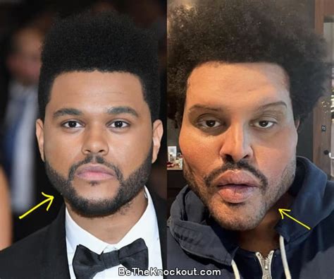 Why Did The Weeknd Get Plastic Surgery: Exploring the Intersection of Art, Identity, and Public Perception